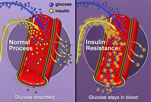 insulin-absorption